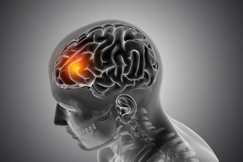 combater Doenças Cerebrais e Distúrbios Neurológicos