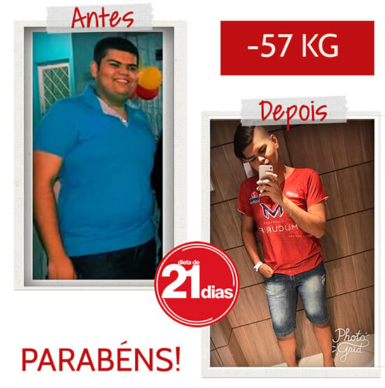 antes depois wilkens d21